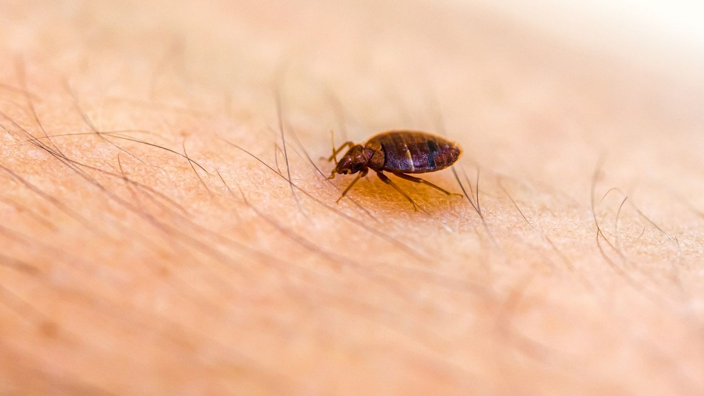 Bed bugs: bed bug running across the hair on a person’s skin.