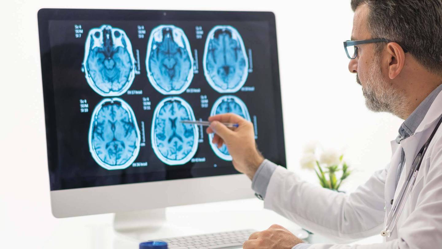 Ein Arzt sieht sich Gehirnscans auf einem Monitor an.