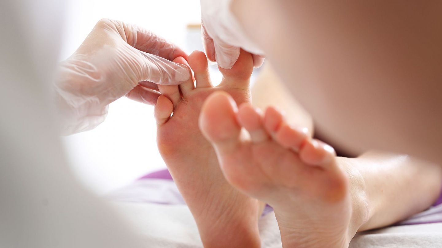 Fußpilz: Eine Person mit medizinischen Handschuhen untersucht die Zehen von zwei Füßen.