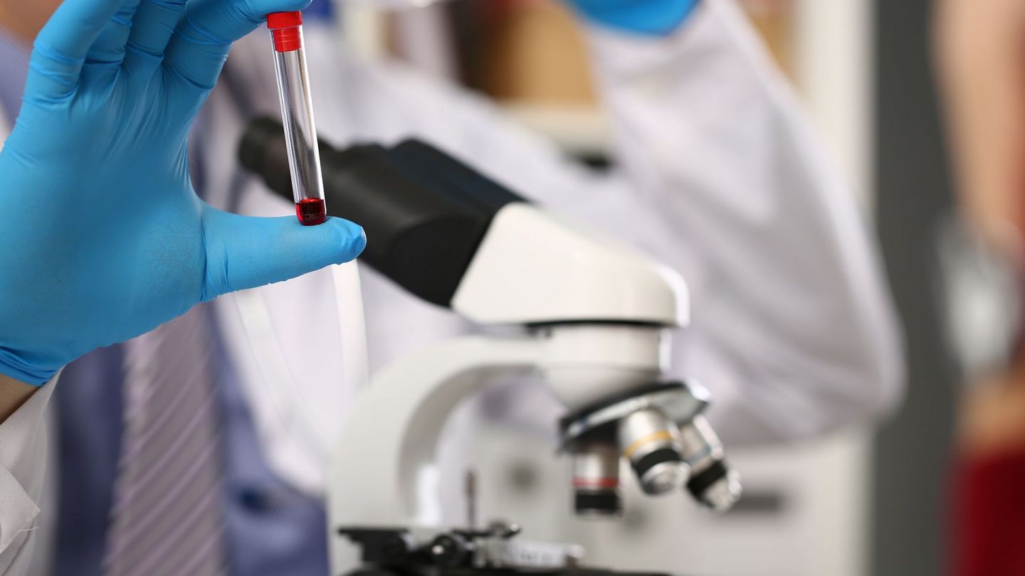Hämophilie: Eine Hand in blauen Medizinhandschuhen hält ein Röhrchen, in dem eine Blutprobe ist. Im Hintergrund ein Mikroskop.