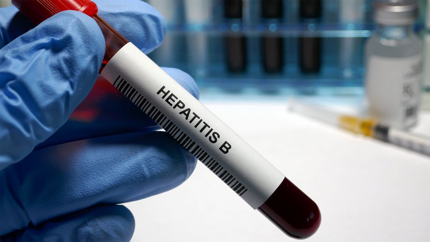 Hand in blue protective glove holding a blood test test tube with a sticker labeled hepatitis B.