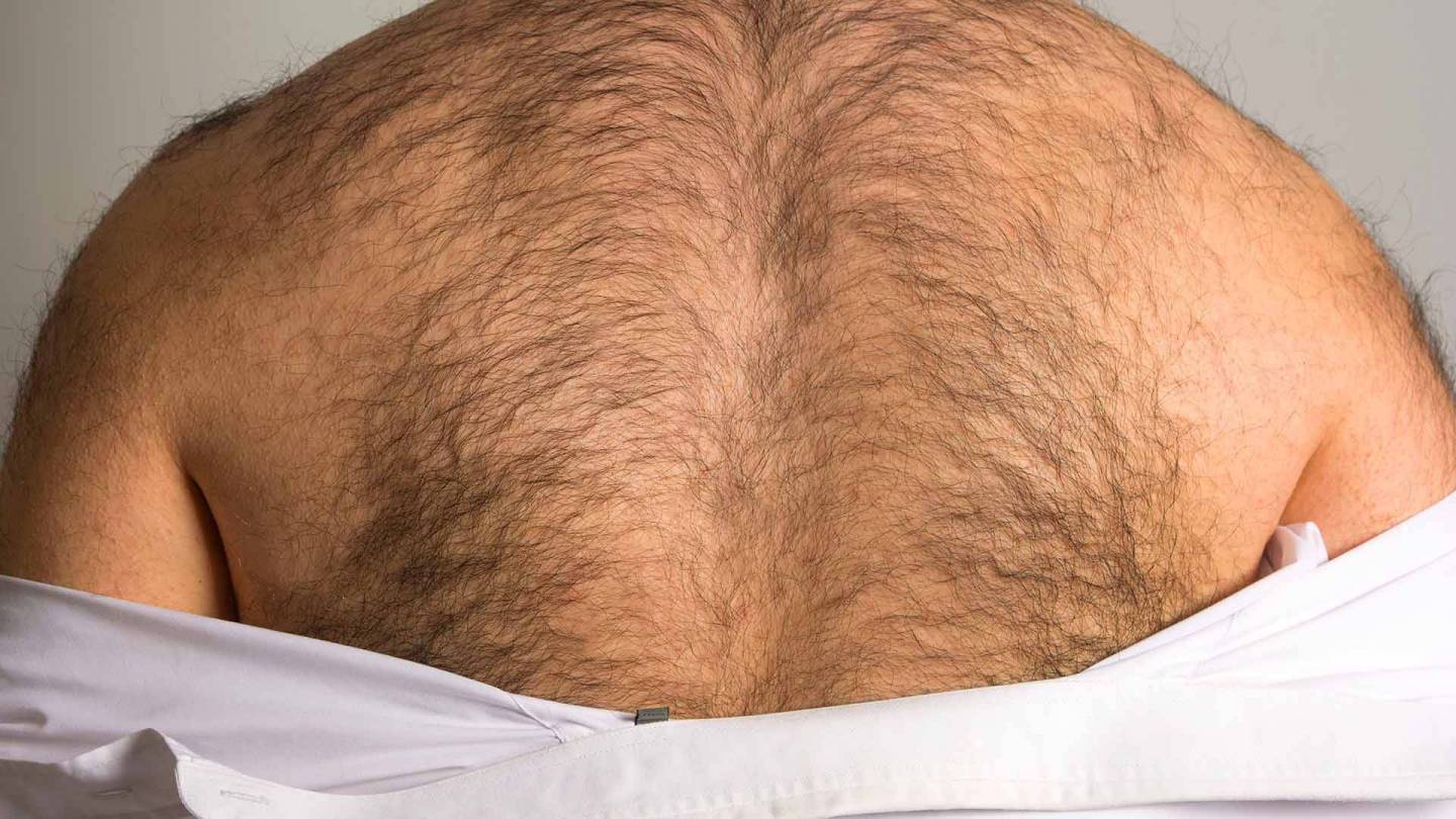A man’s very hairy back