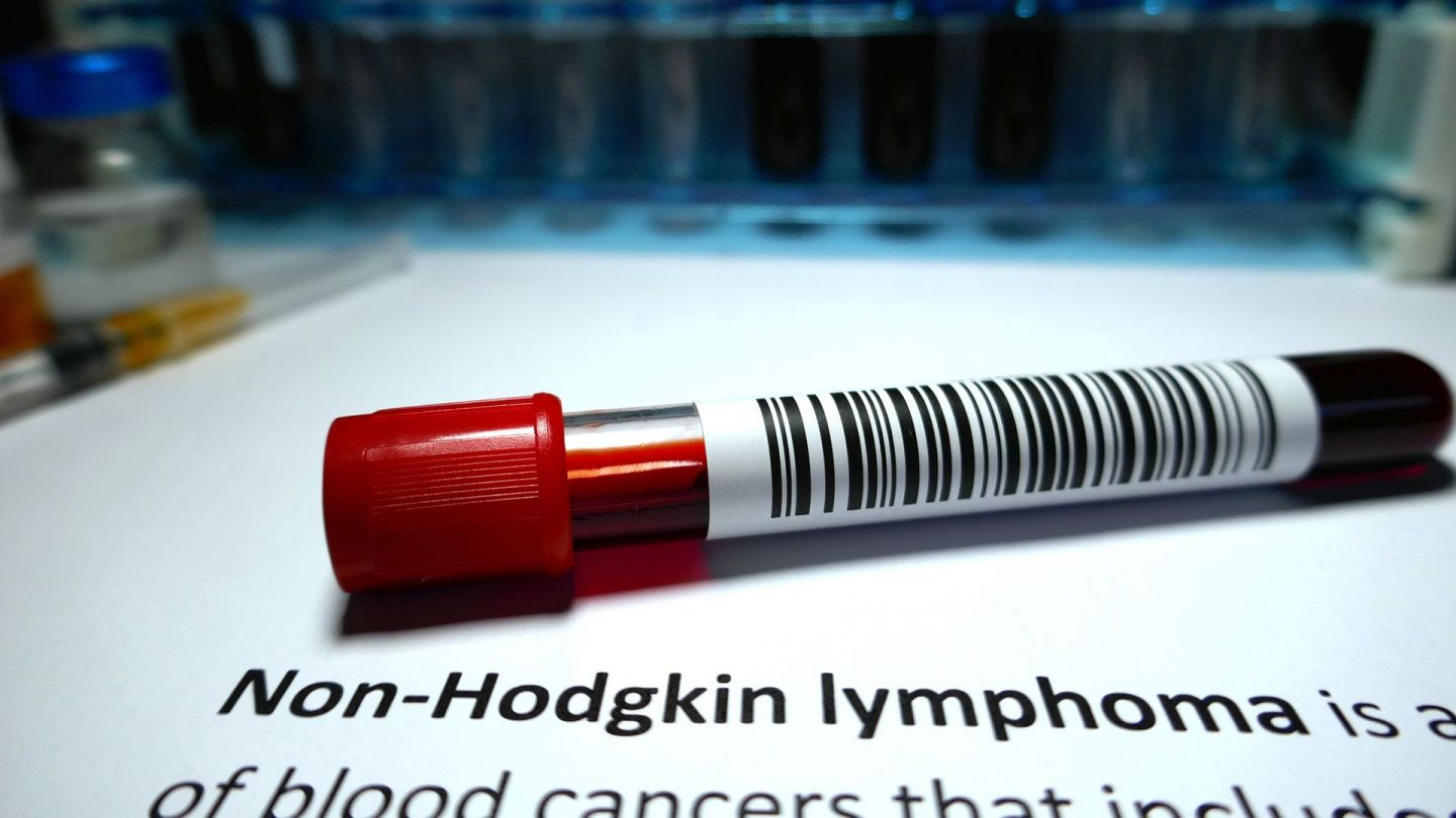 Non-Hodgkin-Lymphom: Auf einem weißen Untergrund liegt eine Blutprobe, die mit einem Barcode versehen ist.