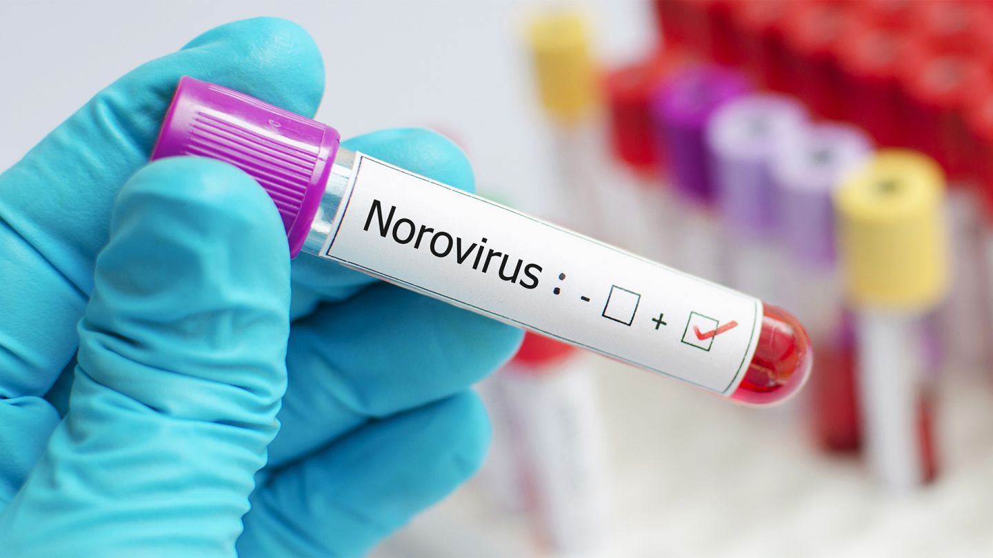 Norovirus: blood test test tube with a sticker for a positive norovirus test.