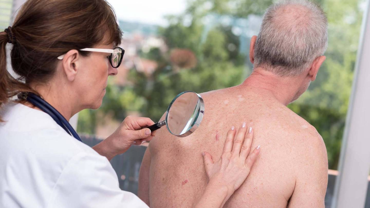 A doctor uses a magnifying glass to examine a rash on an elderly patient’s back.