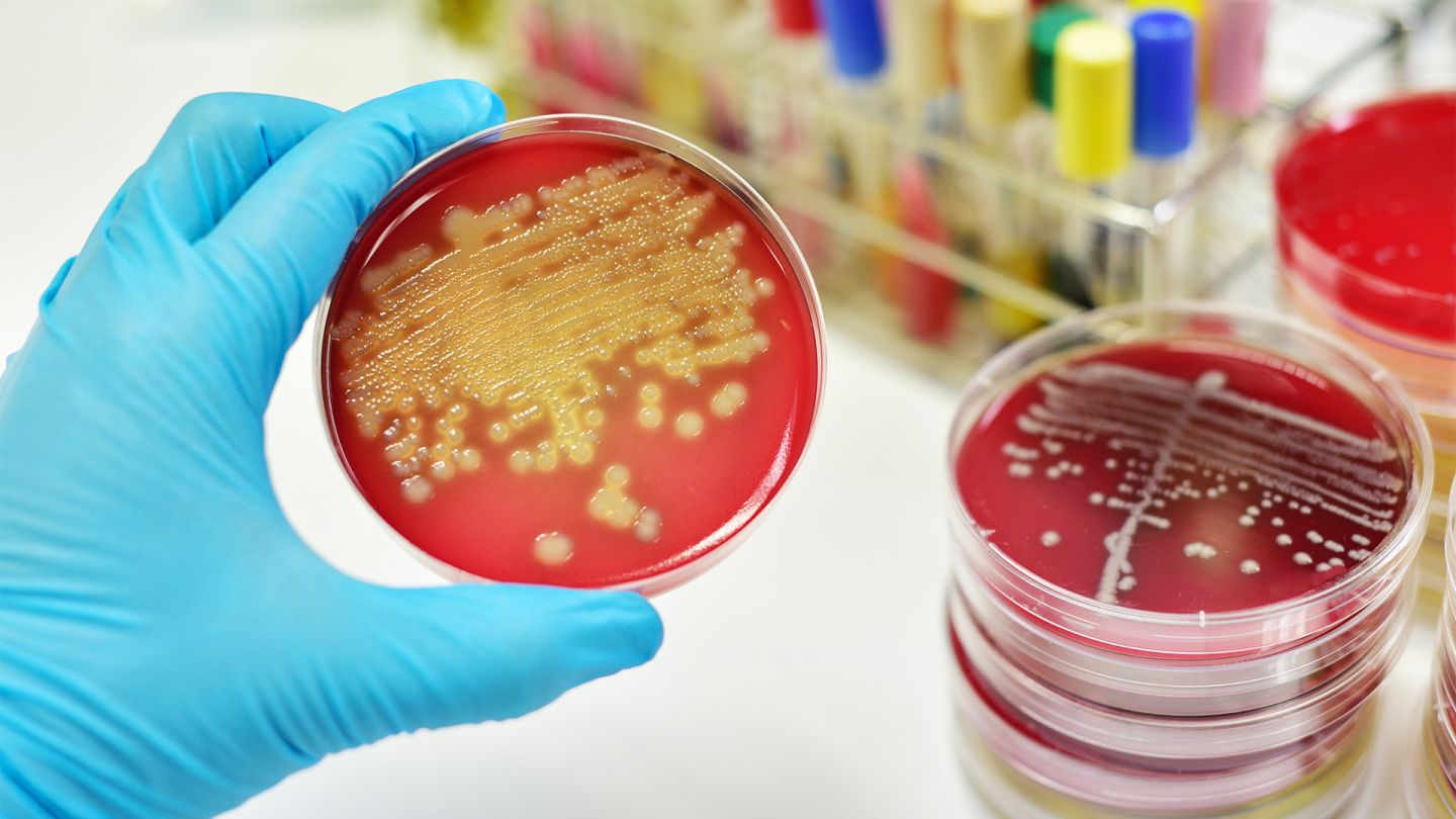 Gloved hand holding a Petri dish in which bacteria cultures are visible. More Petri dishes are standing on the table next to it.