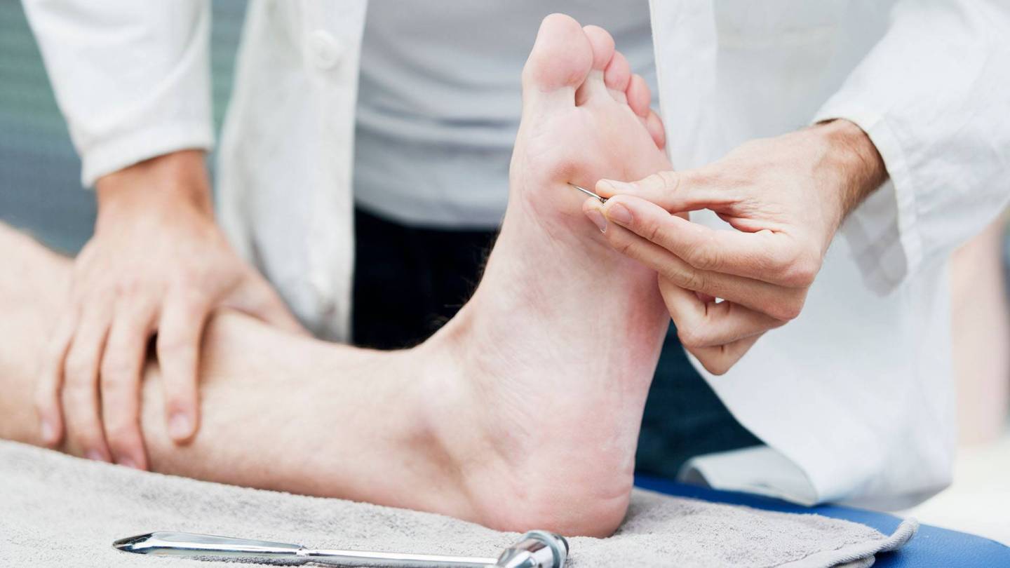 Arzt prüft mit Nadel Schmerzempfinden am Fuß
