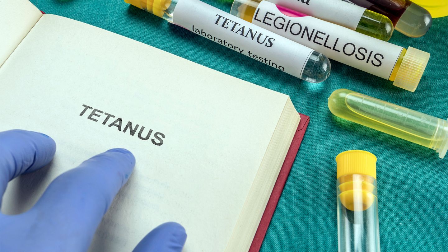 Gloved hand pointing to the term “Tetanus” in an open book. There are a few test tubes containing colored liquids next to it.