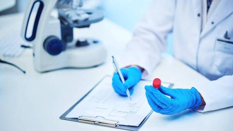 A laboratory worker wearing blue protective gloves fills out an evaluation sheet on a clipboard. He is holding a pen in his right hand and a sample container in his left.