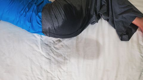 Nocturnal enuresis: adult lying on their side in a bed There is a dark patch on the seat of the trousers. There is a darker patch on the bedsheet at the level of the buttocks. The person has clearly wet themselves and the bed.