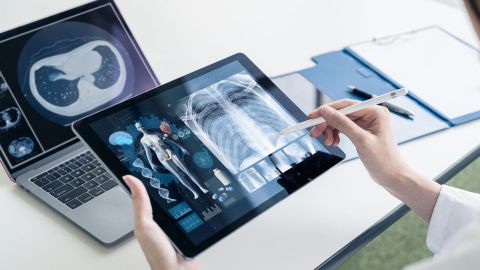 Emergency records: a person in a white coat holding a tablet in one hand and a pen in the other pointing to the tablet screen. The screen shows a 3D model of a human body with an X-ray of a torso.