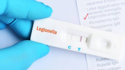 Eine Hand im Schutzhandschuh zeigt einen positiven Antigen-Test auf Legionellen.