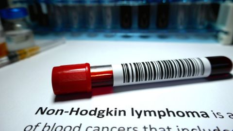 سرطان الغدد الليمفاوية اللاهودجكين: عينة دم بها كود شريطي على خلفية بيضاء.