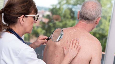 طبيبة تفحص الطفح الجلدي على ظهر مريض كبير في السن باستخدام عدسة مُكبرة.