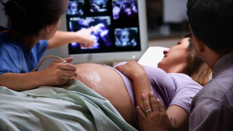 Pregnancy care: gynecologist administering ultrasound scan to pregnant woman. Her husband is sitting next to her with his hand resting gently on her arm. They are both looking at the monitor. The doctor is pointing at the images on it.