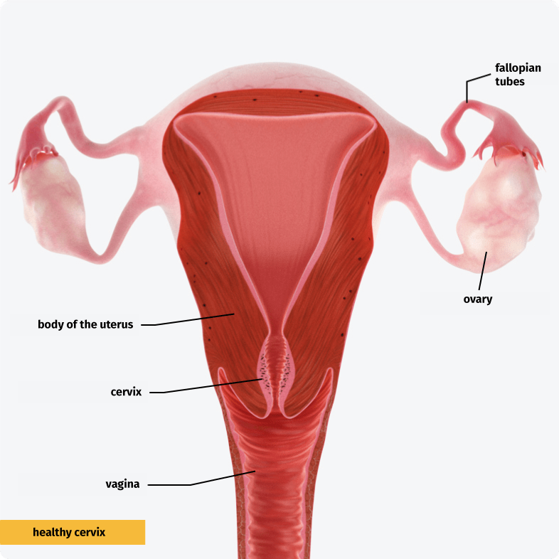 Normal cervix with unaltered mucosa.
