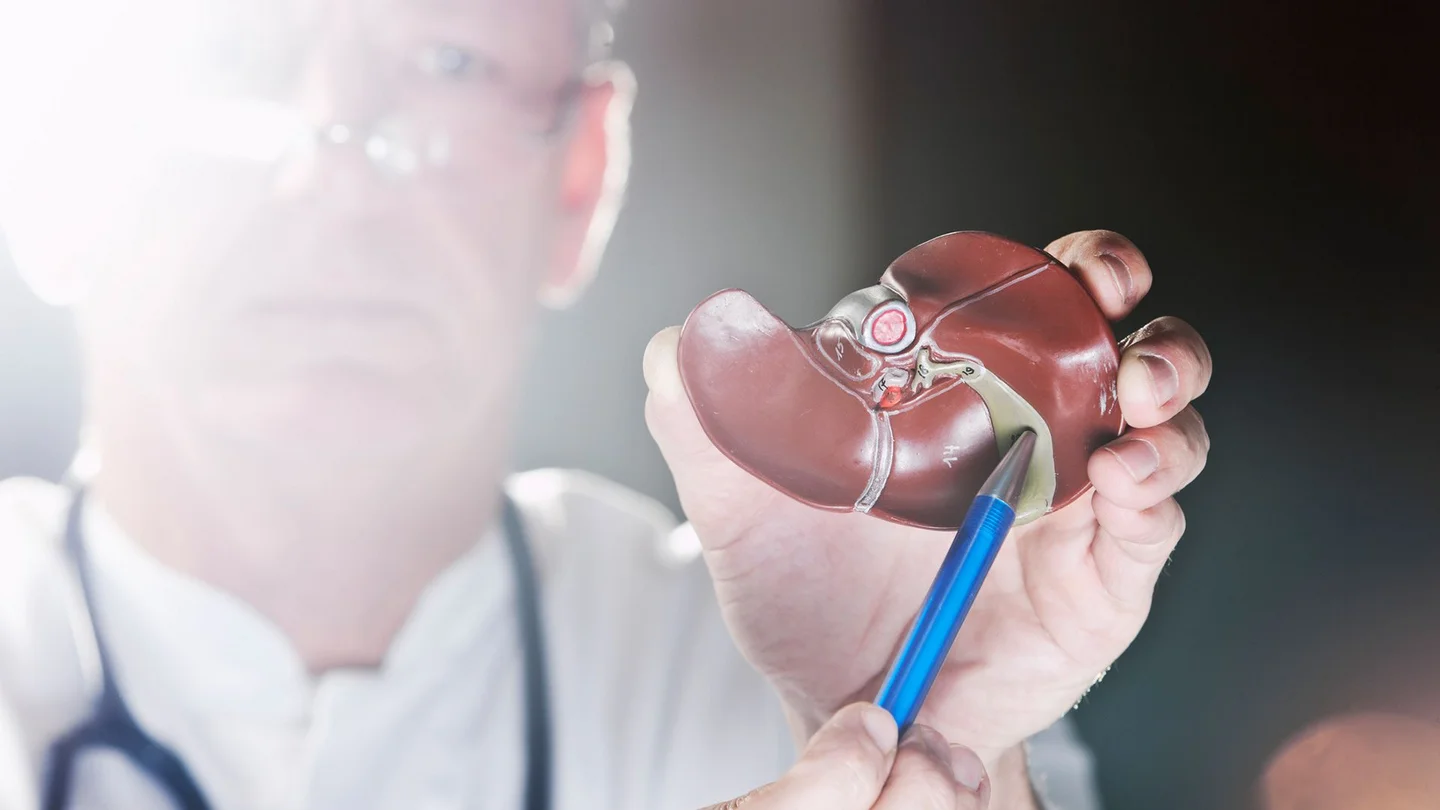 Krebs der Gallenblase und der Gallengänge: Ein Arzt hält in seiner linken Hand das Modell einer Leber mit Gallenblase. In der rechten Hand hält er einen Kugelschreiber, mit dem er auf die Gallenblase zeigt.